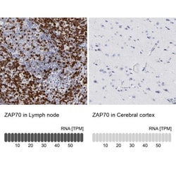 ASB6 Antibody, Novus Biologicals:Antibodies:Primary Antibodies
